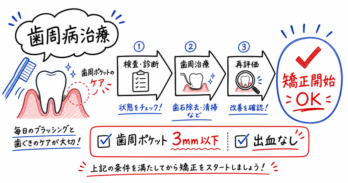 歯周病と矯正治療はどちらが先？望ましい順番と優先すべき理由